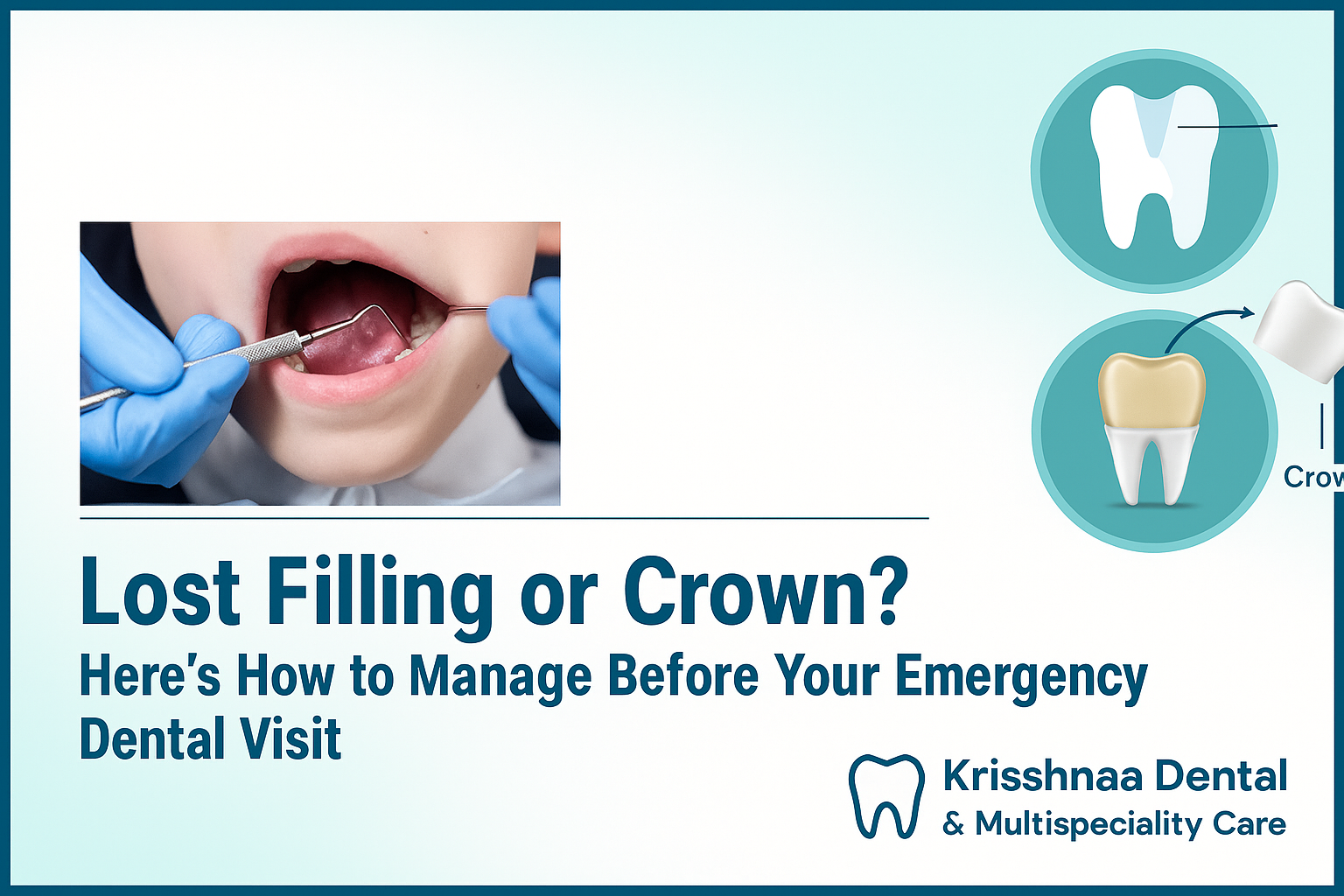Lost Filling or Crown? Here’s How to Manage Before Your Emergency Dental Visit